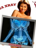 X-Ray